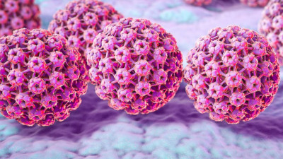 Cancerul de col uterin și bolile cu transmitere sexuală: V-Veil UP2, voalul de auto-prelevare pentru  o detectare mai ușoară a virusului  HPV/Papillomavirus și a bolilor cu transmitere  sexuală